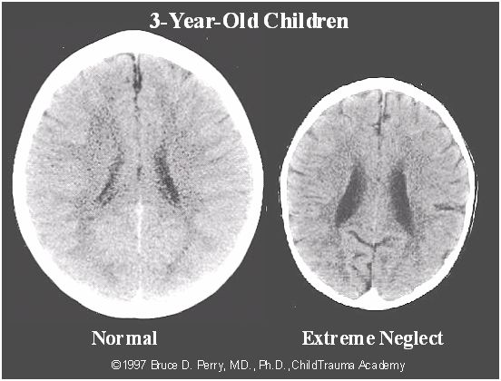 Brain-Size-Comparison