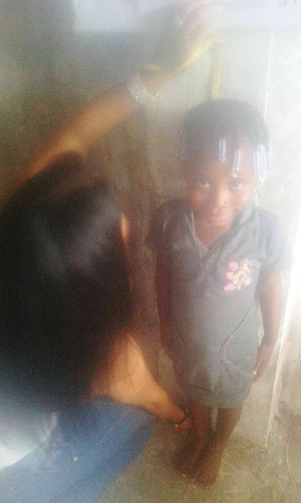 Buenadventura 1 2017 4 Little Girl Getting Measured